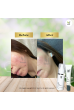 Acne  Pack  Special  (Results : within 7 days)