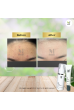 Acne  Pack  Special  (Results : within 7 days)