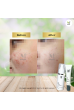Acne  Pack  Special  (Results : within 7 days)